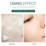 Tea Tree Facial Cleanser 50g - Moisturizing & Cleansing
