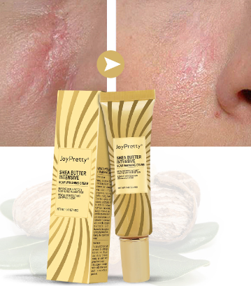 Mango-Shea Butter Scar Removal Cream